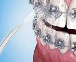 IRRIGADOR DENTAL